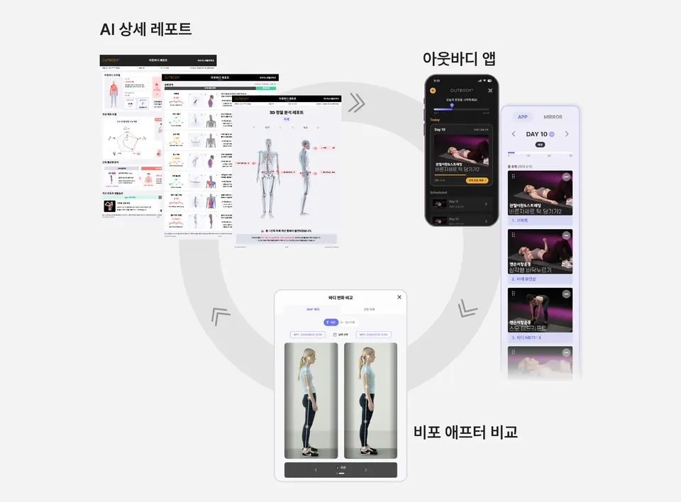 비포 애프터 비교와 AI 상세 레포트